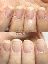 マリーロール 梅田店(Marie Laure)/自爪育成/深爪矯正/ネイルケア
