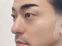 スキン 心斎橋店(skin)/眉のお手入れはプロにお任せ★