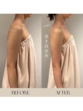 インフィニーズ(INFINEEZ)/カスタマイズ90分姿勢矯正20代