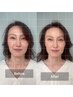 もうメイクでごまかさない。本気の小顔30分 【mini小顔造形】