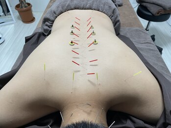 ハリトト鍼灸院/自律神経を整える鍼灸施術