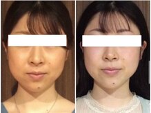 美容整体 ウェリナ 蟹江院/小顔矯正/骨盤矯正/美脚サロン 