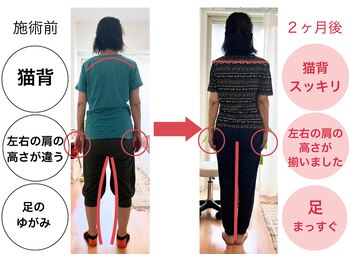 いろどり整体/【７０代女性】猫背、ゆがみ改善