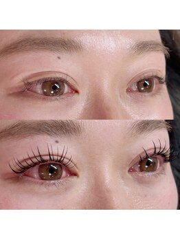 フランキンセンス 香取佐原店/＆ヘルシービフォーアフター