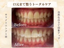 ミスティア(mistia)の雰囲気（食事制限・禁煙不要☆清潔感のある自然な白さ◎口臭ケアにも♪）