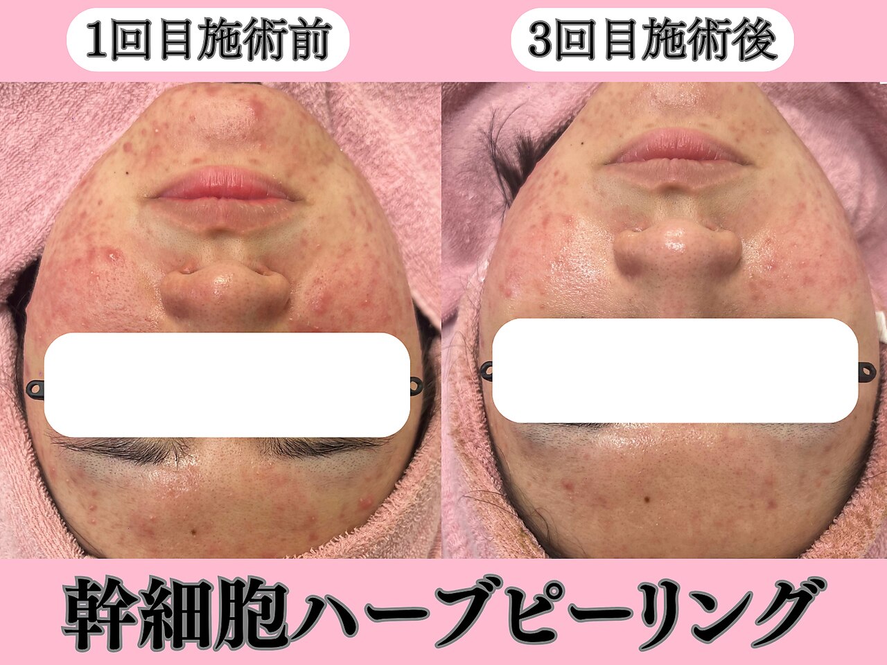 エンクリニカルラボ 三宮店(E&N CLINICAL LABO)｜ホットペッパー