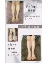 ルル(LuLu)/泡パック　フット