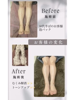 ルル(LuLu)/泡パック　フット