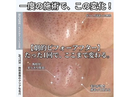 ハローハローアイラッシュ(Hello.Hello.eyelash)の写真