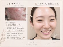 スイ(sui)の雰囲気（悩んだからこそお客様に寄り添い、結果にこだわります。天久保）