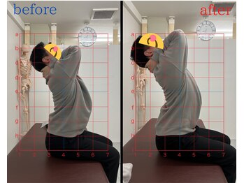 トワニ整体 新富町院(TOWANI整体)/頭痛/銀座/新富町/築地/整体
