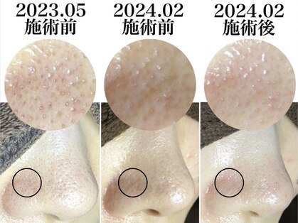 美鼻ラボ 押上 曳舟の写真