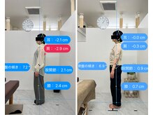 トワニ整体 新富町院(TOWANI整体)/腰痛/銀座/新富町/築地/整体