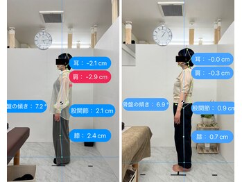 トワニ整体 新富町院(TOWANI整体)/腰痛/銀座/新富町/築地/整体