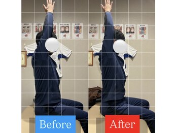 ナオル整体 宮崎院(NAORU整体)/50代男性施術事例【肩こり改善】