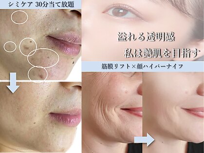 椿(TSUBAKI)の写真