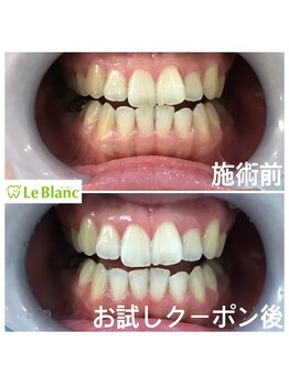 ルブラン 奈良店(Le Blanc)/お得なコース!期限無!回数券!