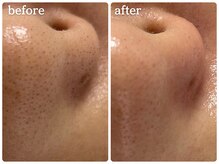 メルシア(merucia)/