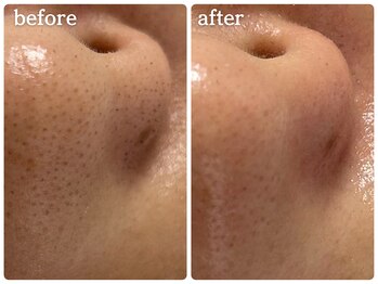 メルシア(merucia)/