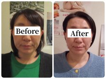 マンマ ジュンナ/【浜松/小顔/小顔矯正】