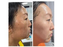 エクラ イオンモール徳島店(ECLAT)の雰囲気（根本から肌を変える/ハリツヤ改善/四国初インセルダム正規販売店）