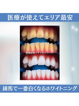 スマイルホワイト 練馬店の写真/しっかり白く、リーズナブルに白くするなら医療提携ホワイトニング・スマイルホワイトにお任せください！