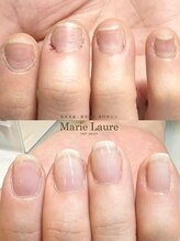 マリーロール 梅田店(Marie Laure)/自爪育成/深爪矯正/ネイルケア