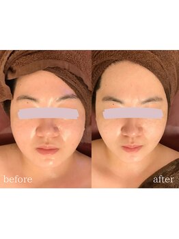 小顔美肌コルギ専門店 センティード 吉祥寺(Sentido)/