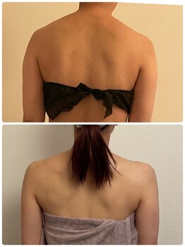 レナティス(Renatis)/