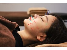 小林整骨院 塚口/オーダーメイド美容鍼