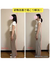 ベルフルール(Belle Fleur)/フェムケア矯正