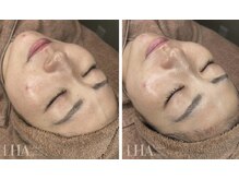 ルルアス(LuLu AS)/