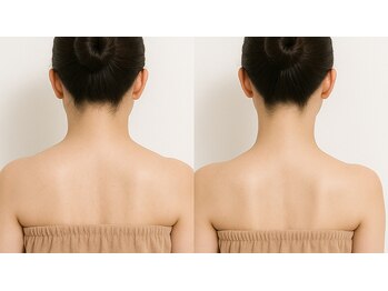 オリエンタルローザ 表参道(Oriental Rosa)の写真/薄着の今こそ華奢見えに!肩幅スッキリ<肩コリ徹底解消>速攻サイズダウン★頑固なコリも◎話題の技術で¥7700