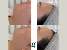 グレイスリリー(grace lily)/