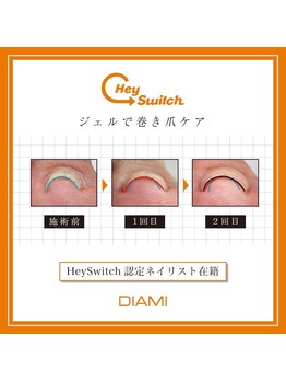 エール(Ailes)/巻爪ケアヘイスイッチ/HeySwitch