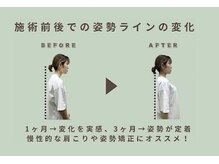 ストレッチリヴェラ(STRETCH LIVERA)/【気になる猫背や巻き肩に】