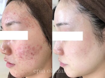 エピア 岡崎店(Epia)