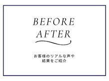ニキビ研究所 浦和店/BEFORE AFTER