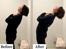 ソレア(Solea)/下半身硬さ改善 1回目