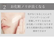 サラ 恵比寿店(SARA)/２フォトRF顔脱毛のメリット