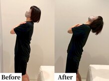 ソレア(Solea)/腰痛改善1回目