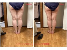 ミュー 新小岩店(Mieux)/Wマシン下半身痩せ