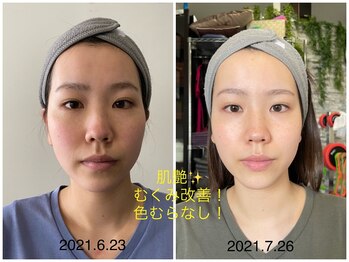 ビー バランス(Be.BALANCE)/透き通る美肌に！