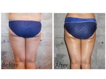 ライトウェーブ 松本村井本店/30代　ヒップアップして小尻に！