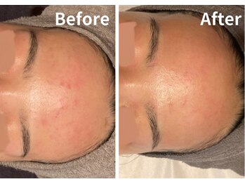サロン デ ミロ(Salon de Miro)/BeforeAfter多数！ブログへGO♪
