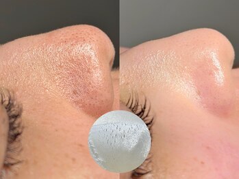 ルーナジェーナ(Luna llena)/池袋　エステ　ルーナジェーナ