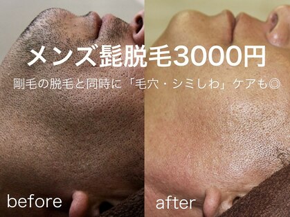 ラフラフ(Laf Laf)の写真