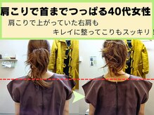 鍼灸 整体院 ひわたし/首までつっぱる肩こりもスッキリ