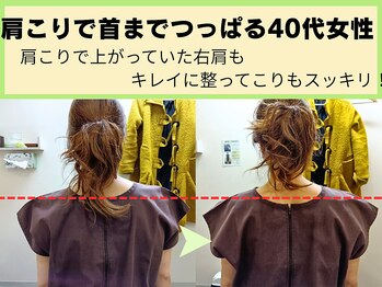 鍼灸 整体院 ひわたし/首までつっぱる肩こりもスッキリ