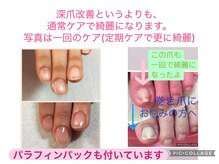 ネイルセラピーサロン プラムジュース(Nail Therapy Salon Plum Juice)の雰囲気（不快感のある爪も綺麗に。。ハンドはパラフィンパック付）